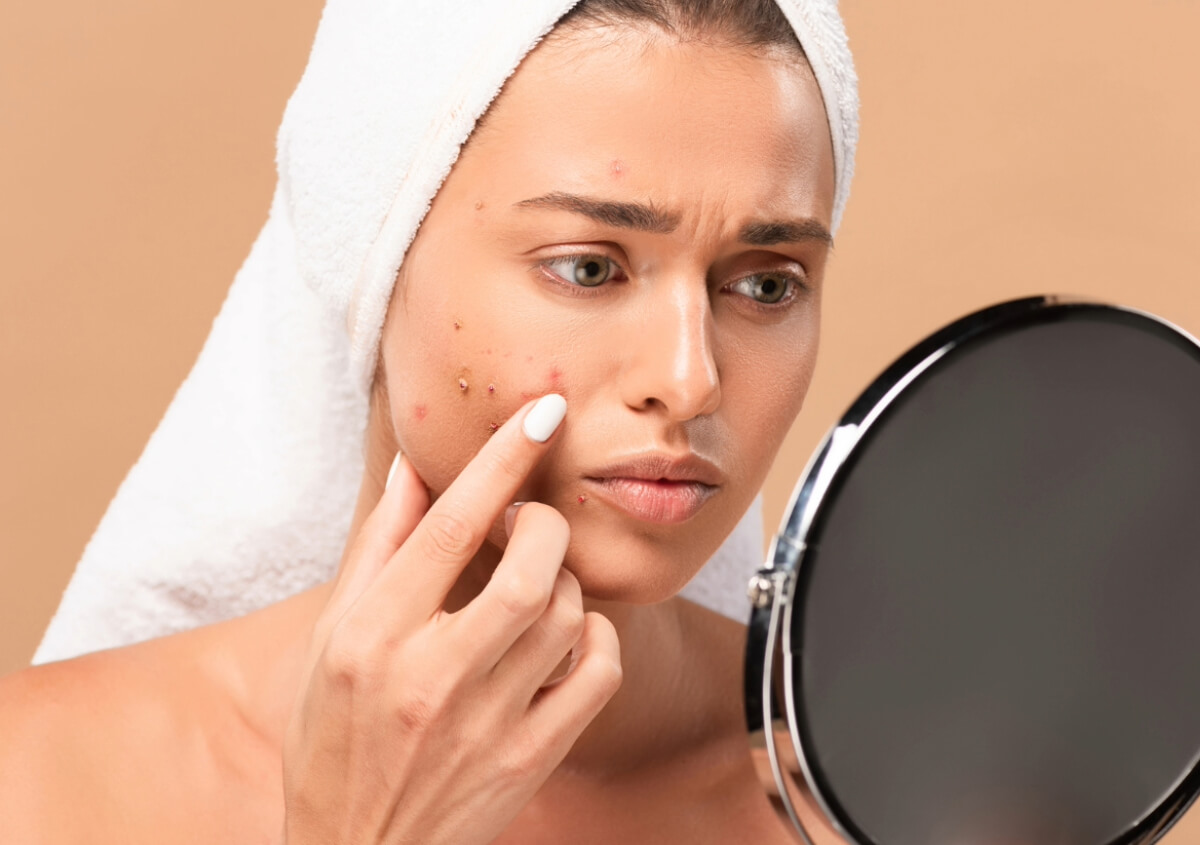 Acne Removal Treatment in New York area